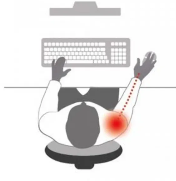 PainTopVIew